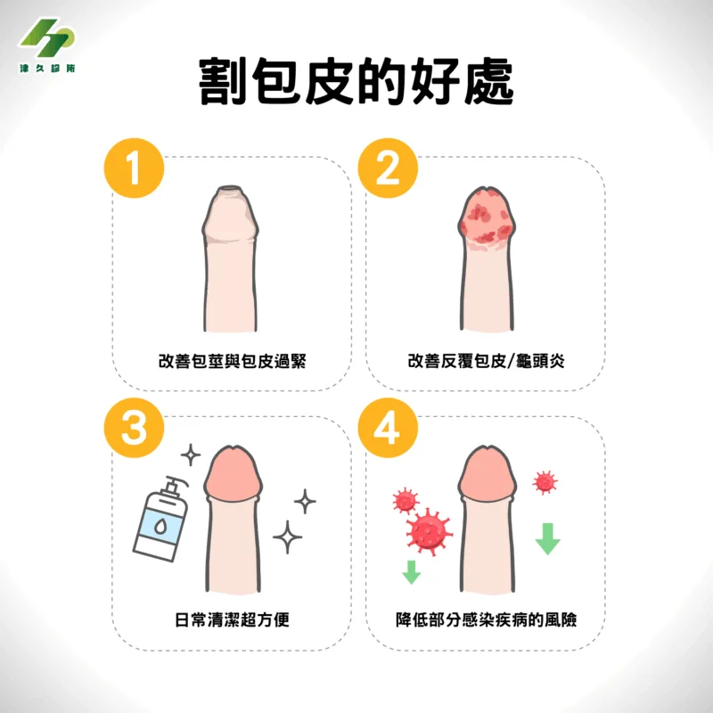 割包皮的好處